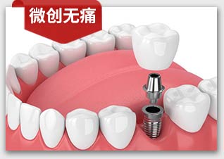 威尼斯app游戏平台