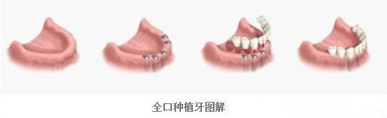 威尼斯app游戏平台