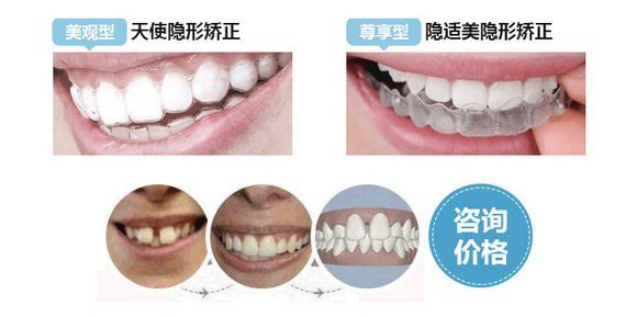 威尼斯app游戏平台