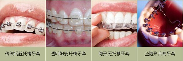威尼斯app游戏平台