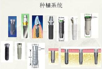 威尼斯app游戏平台