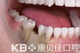 威尼斯app游戏平台