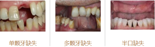 威尼斯app游戏平台
