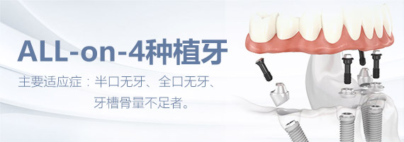威尼斯app游戏平台